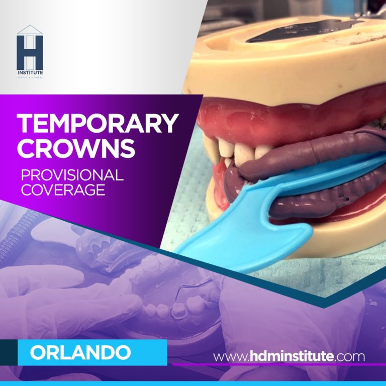 TEMPORARY (CROWNS&BRIDGES) HANDON HDM INSTITUTE