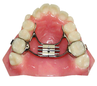 Advanced Orthodontic Retainers and Appliances Course [Orlando] – HDM ...