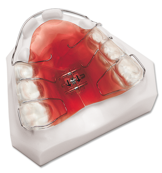 Advanced Orthodontic Retainers and Appliances Course [Orlando] HDM
